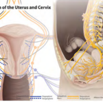 Comparison of Efficacy between Nitrous Oxide Analgesia and Pericervical Analgesia in Office Operative Hysteroscopy with 16 Fr Mini-Resectoscope: A Randomized Clinical Pilot Study